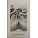LEJARS, Féjix. - TRAITE DE CHIRURGIE D'URGENCE. 994 figures dont 602 dessinées par le Docteur E. DALEINE et A. LEUBA, 217 photographies originales, 20 planches hors texte. Sixiéme edition, revue et augmentée.  